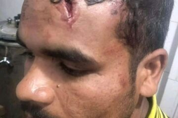 रोल्पामा जातीय विभेदका आधारमा बालक र पुरुषमाथि निर्घात कुटपिट