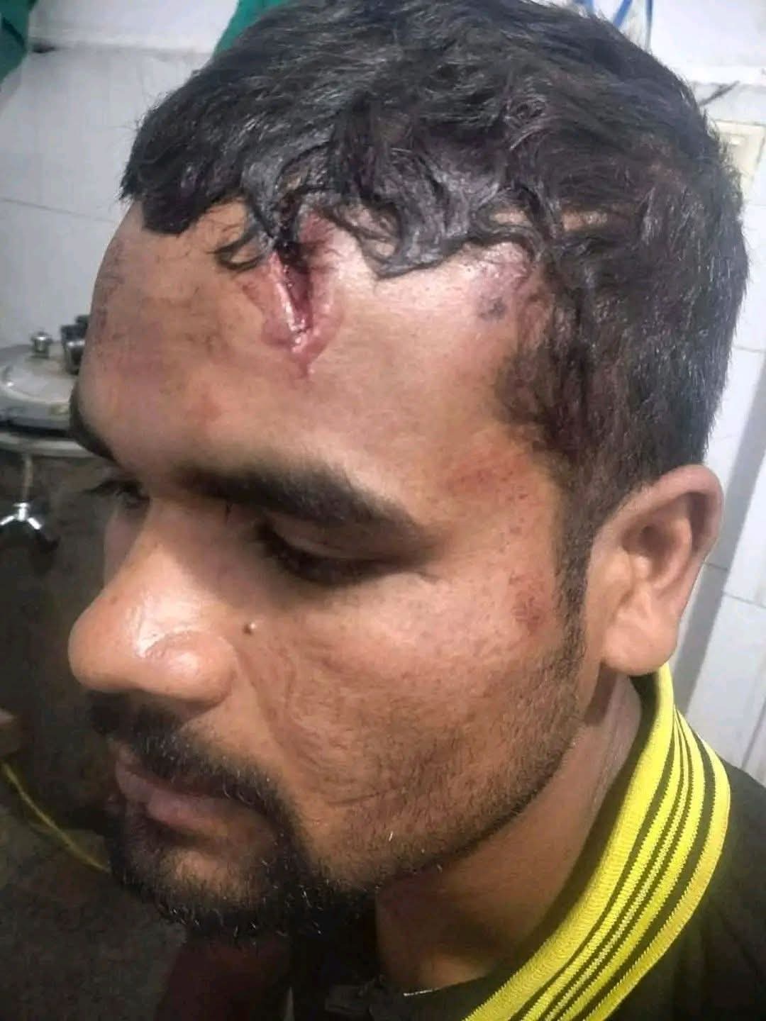 रोल्पामा जातीय विभेदका आधारमा बालक र पुरुषमाथि निर्घात कुटपिट